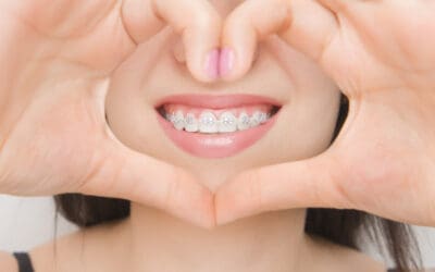 Best Teeth Aligners for Comfortable and Quick Results